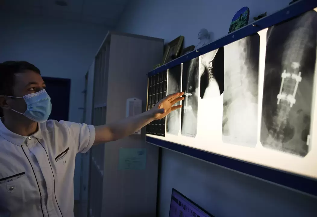 I medici diagnosticano l’osteocondrosi cervicale utilizzando metodi strumentali, come la radiografia